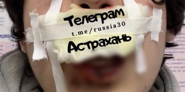 В центре Астрахани толпой избили прохожих 