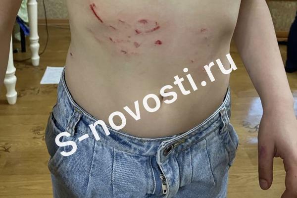 В Астрахани собаки едва не разорвали 7-летнюю девочку