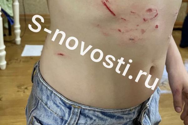 В Астрахани собаки едва не разорвали 7-летнюю девочку