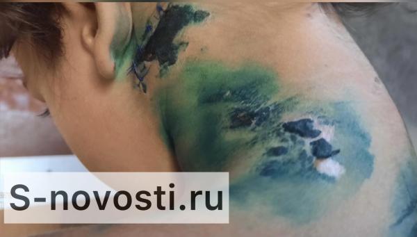 В Астрахани ребёнок попал в реанимацию после нападения собак